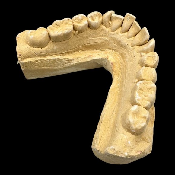 Vintage Plaster Dental Mold - Teeth Tooth Mold - Creepy Oddity - Dental Oddities - Picture 7 of 16